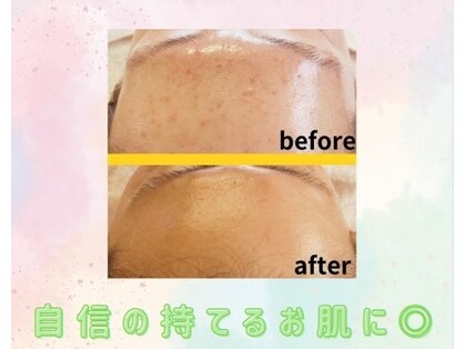 サロンこみちの写真