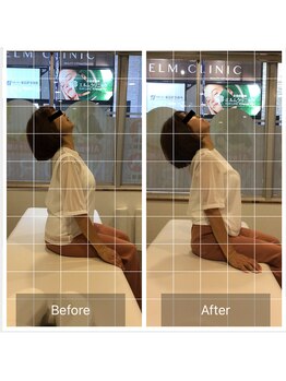 ナオル整体 熊本院(NAORU整体)/【60代女性施術事例 頚部伸展】