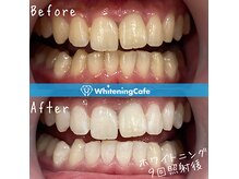 ホワイトニングカフェ 大宮西口店の雰囲気(ホワイトニングの症例写真はフォトギャラリーをチェック!)