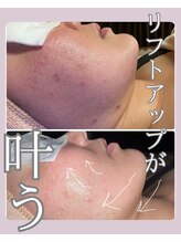 ヒーリングリゾート ナゴミ(Nagomi)/クリスタルフォト