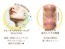 アルッカ(Arukka)