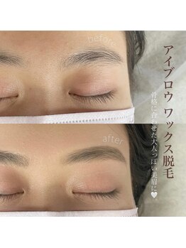 ディンプル(Dimple)/アイブロウWAX脱毛☆