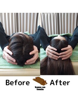 クマの冬眠 高知店/頭皮とお顔のケア