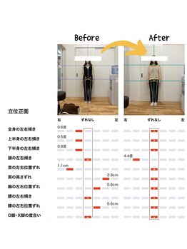 篠丸接骨院/◎施術実績◎全身の歪み改善!