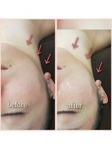 エクラ(eclat)/特殊リフトアップマシン