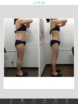 健康痩身研究所 名和店/ビフォーアフター