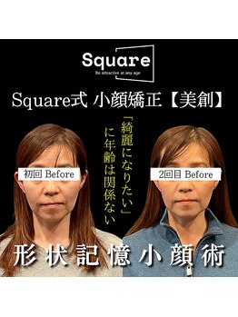 スクエア整体院(Square整体院)/小顔矯正 Before→After