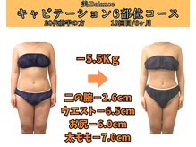 ビーバランス 本町店(美-Balance)/20代前半　月6部位コース