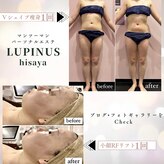ルピナス ヒサヤ(LUPINUS hisaya)