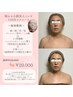 眠れる小顔美人コルギ 【110分】ヒト幹細胞導入＆石膏パック付¥22.000