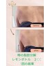 【噂の】脂肪分解レモンボトルで気になるところの脂肪撃退