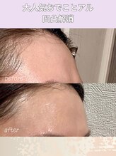 エン 橿原店(en)/おでこヒアル大人気です