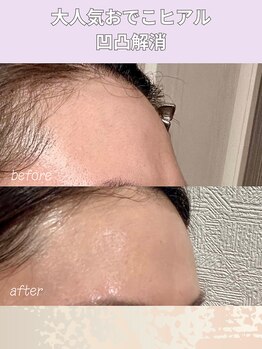 エン 橿原店(en)/おでこヒアル大人気です