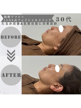 ルーナ(LUNA)/たるみ改善＋トーンアップ♪