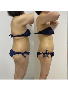 シュエットプラス(Chouette+)/ここまで痩せたい!