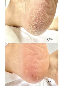 ラヴィ(La vie)/サンダルの季節