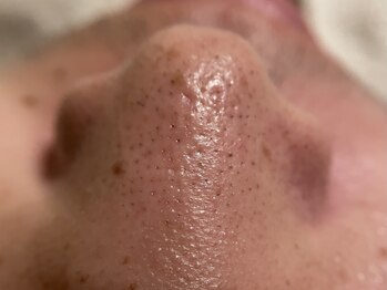 リセットプラス(Reset+)/