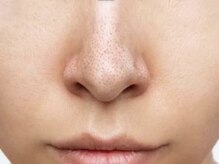 【池袋で大人気】美肌の基本のケアメニューが充実＊洗顔サロン人気メニュー／プランのご紹介