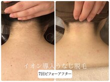 リノ(Lino)/うなじ脱毛シェービング付き♪