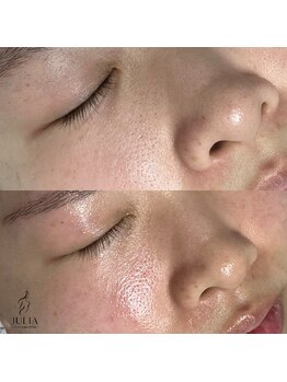 ネイルビューティー アンドエム(Nail Beauty & M)/