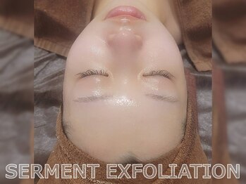 セレブリボーン 大阪ボーテ/セルマンピーリング