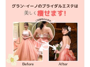 グラン イーノDAY SPA クレフィ三宮店/ブライダルエステについて6