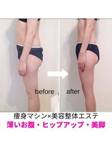 ワンモア 新町店(1+MORE)/今年こそ自信が持てる水着姿に★