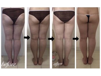 美人バスト 岡崎店/50代のお客様ダイエット