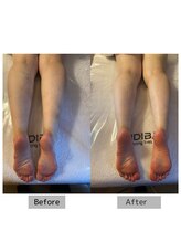 ウィッシュプロサロンケー(WISHpro salon K)/インディバ1回ふくらはぎケア