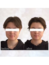 ビスイ 恵比寿(Bisui)/小顔矯正/小顔/ヘッドスパ