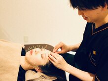 ツボを押さえた鍼施術は即効性◎