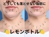 韓国発！脂肪撃退【レモンボトル】5ml   ¥29700→
