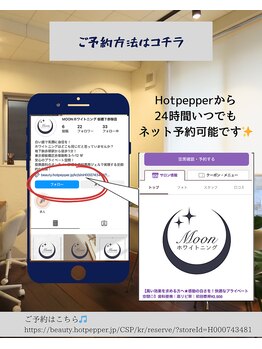 ムーンホワイトニング(Moonホワイトニング)/予約方法