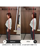 ルピナス整体院/骨盤矯正後の横から見た写真