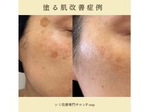 ピーナップ(P-nap)の雰囲気（丁寧なカウンセリングでお悩みを改善へ導きます）