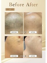 ポノ アンド マルン(Pono&Marun)/