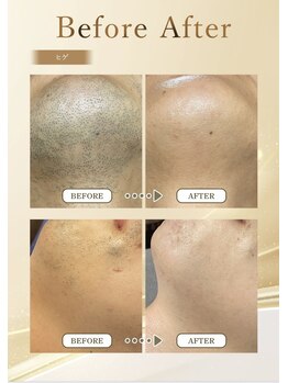 ポノ アンド マルン(Pono&Marun)/