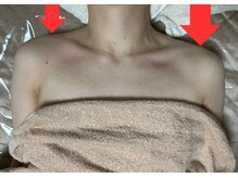 モア 鈴鹿店(more)/骨格を整えて肩幅、巻き肩改善！