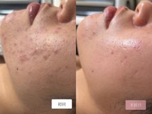 エピル(EPIL)の雰囲気(長さ統一ハリハーブだからこそ叶う美肌へ《スピキュールハーブ》)