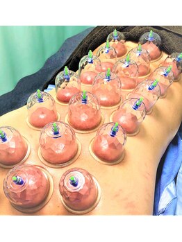 オルカ たまプラーザ駅前店(ORCA)/オイルカッピングもおすすめ☆