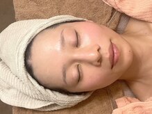 エムスパサロン マモ(Mspa salon mamo)/最先端の肌質改善ピーリング