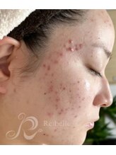 リン 長崎 大村(Rin)/before