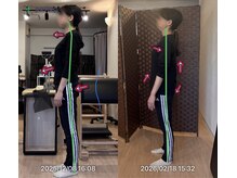 ピース(Peace)/Before→After