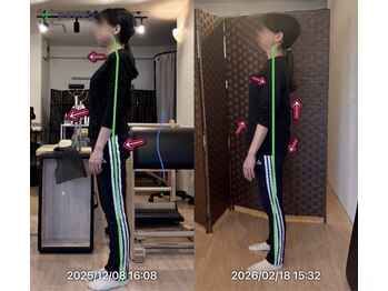 ピース(Peace)/Before→After