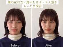 チャンス 西院(chance)/【変化】エラ/顔の左右差/むくみ