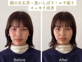 チャンス 西院(chance)/【変化】エラ/顔の左右差/むくみ