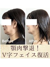 スウ(suu.)/Before-After【40代】8 回