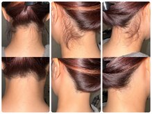 ワイズサロン(Y's salon)/うなじ脱毛