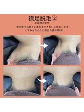 ベルミ―ランド いなげや大和相模大塚/襟足脱毛２
