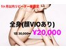 【女性のみ】1ヵ月以内来店★都度払い/全身脱毛(顔vioあり)30000円→20000円